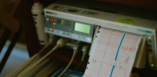 Close-up of an ECG machine displaying heart rate results in a hospital setting.