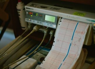 Como medir a frequência cardíaca durante o treino de forma eficaz Close-up of an ECG machine displaying heart rate results in a hospital setting.