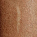 fws-slide-6-1775087044